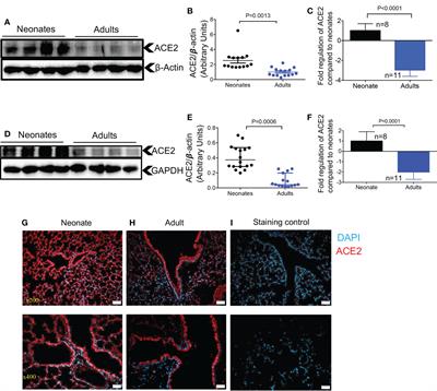 Differential effects of age, sex and dexamethasone therapy on ACE2/TMPRSS2 expression and susceptibility to SARS-CoV-2 infection